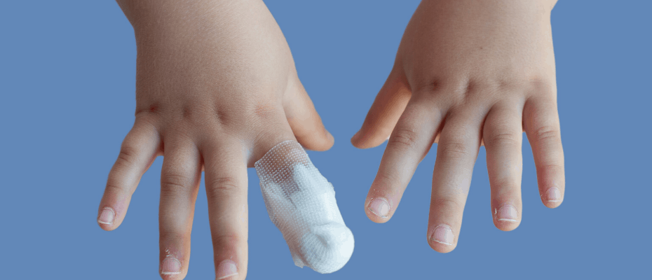 Child Trapped Finger